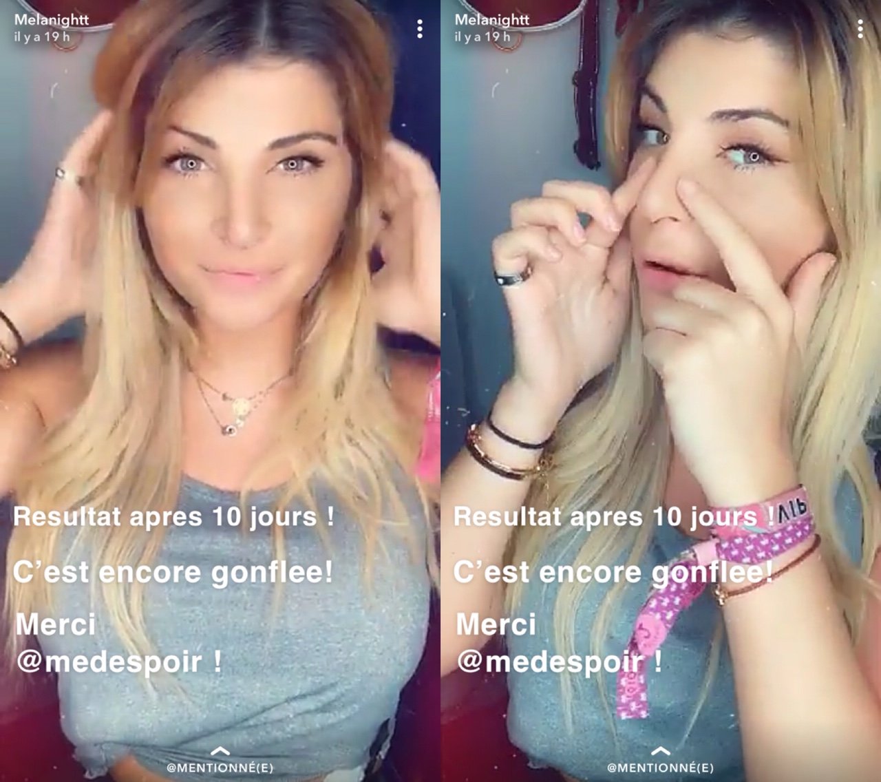 découvrez la transformation de mélanight, son évolution personnelle et professionnelle, ses changements marquants et les moments forts de son parcours.
