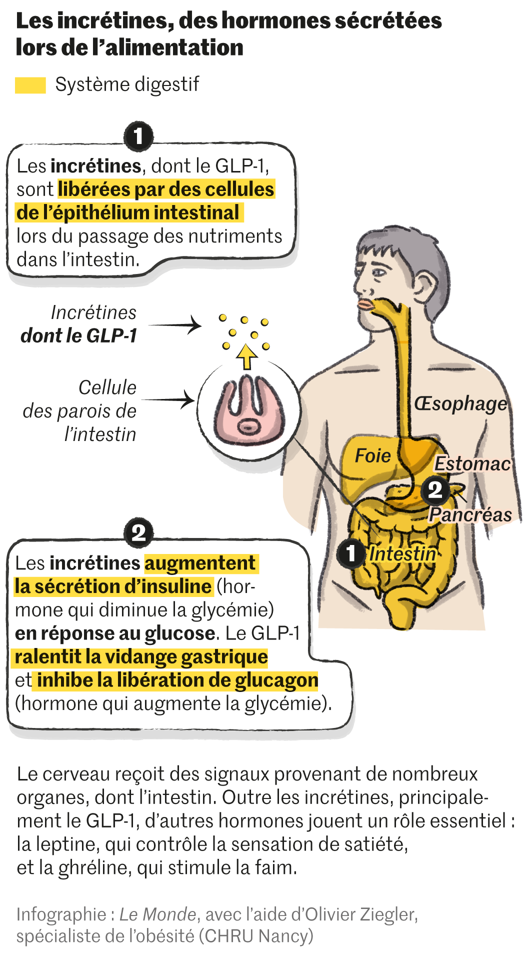 les médecins intensifient leurs appels aux cliniques spécialisées pour améliorer le traitement de l'obésité, favorisant une prise en charge plus efficace et personnalisée.